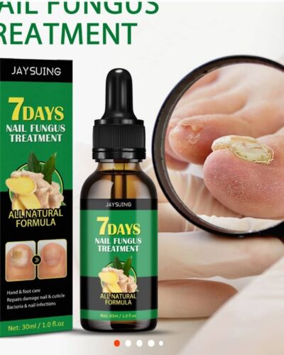 Nail Fungus Treatment