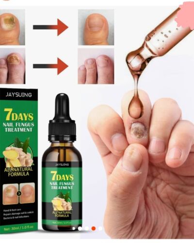 Nail Fungus Treatment